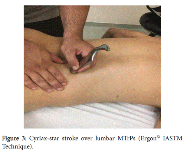 novel-physiotherapies-Cyriax-star