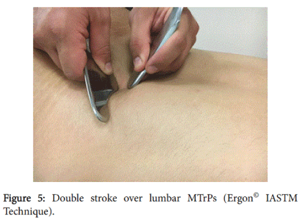 novel-physiotherapies-Double-stroke