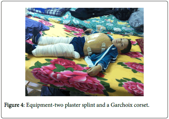 novel-physiotherapies-Equipment-two-plaster