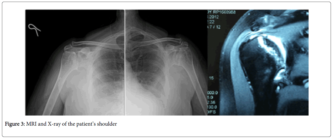 novel-physiotherapies-MRI-X-ray-patient-shoulder