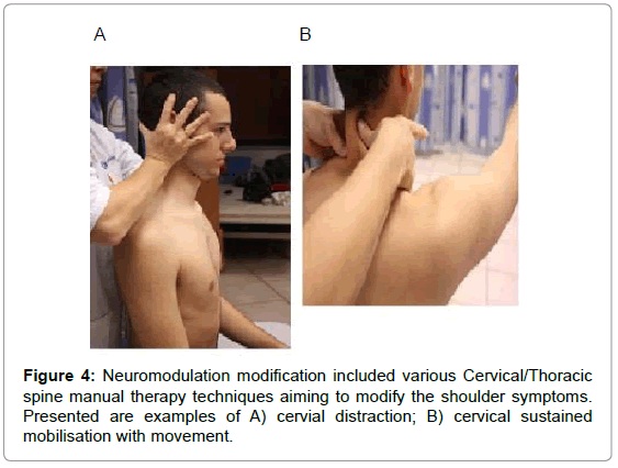 novel-physiotherapies-Neuromodulation-modification-included