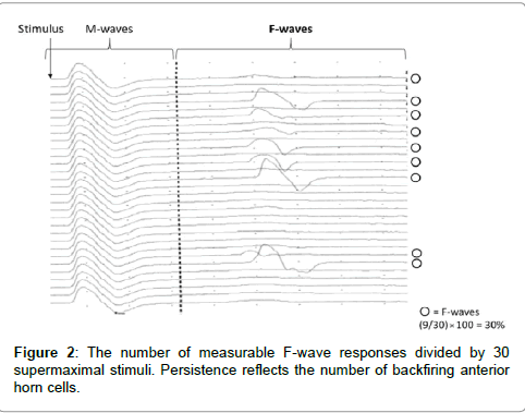 novel-physiotherapies-Persistence-reflects