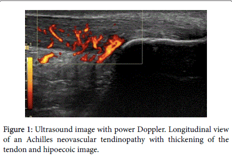 novel-physiotherapies-Ultrasound-image