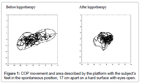 novel-physiotherapies-area-described