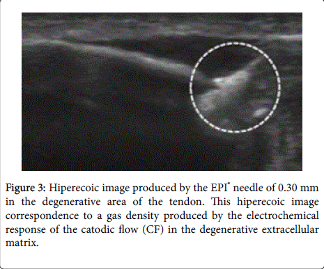novel-physiotherapies-gas-density