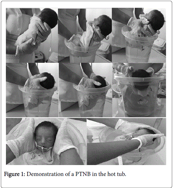 novel-physiotherapies-hot-tub