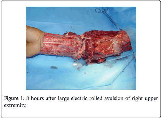 novel-physiotherapies-large-electric