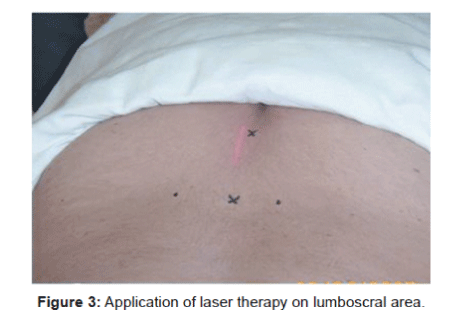 novel-physiotherapies-laser-therapy