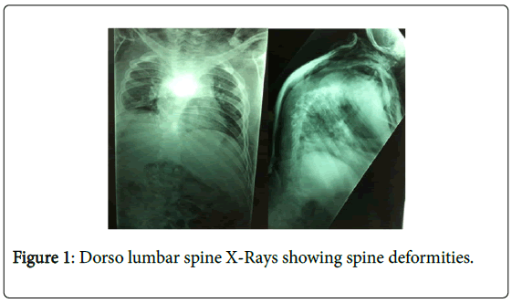 novel-physiotherapies-lumbar-spine