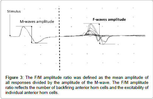 novel-physiotherapies-mean-amplitude