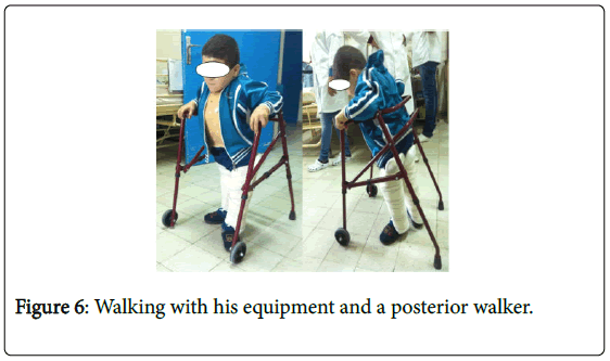 novel-physiotherapies-posterior-walker