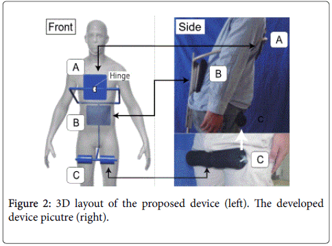 novel-physiotherapies-proposed-device