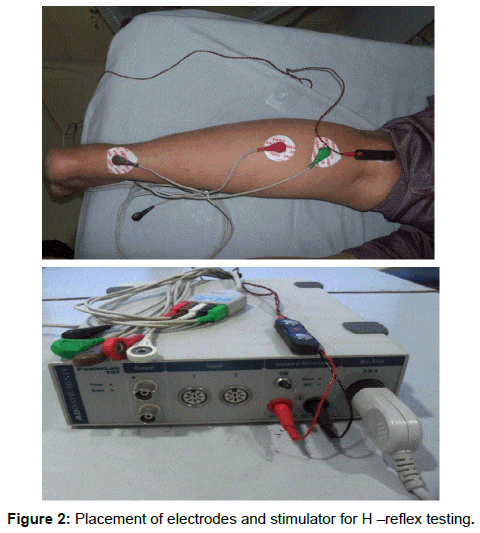 novel-physiotherapies-reflex-testing