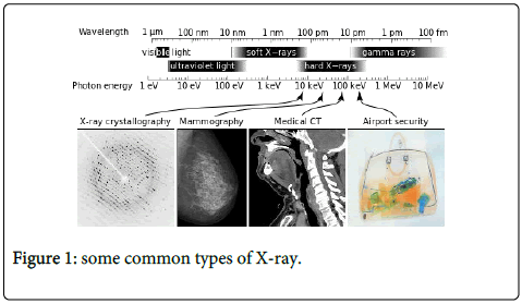 the effects of x rays radiation on embryonic and fetal during nuclear medicine common types