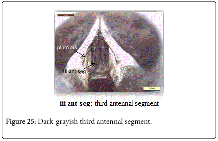 nursing-forensic-studies-Dark-grayish-third-antennal