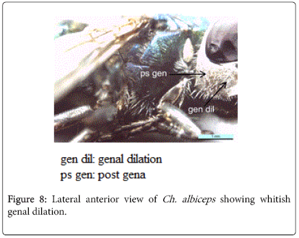 nursing-forensic-studies-Lateral-anterior-view