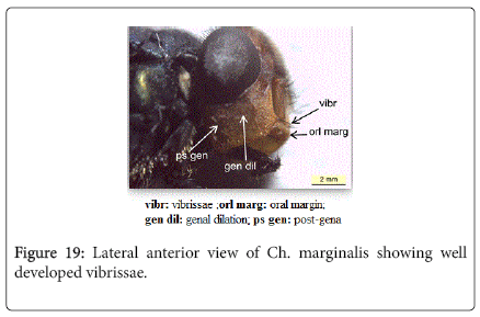 nursing-forensic-studies-Lateral-anterior-view-Ch-marginalis