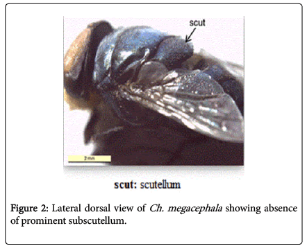 nursing-forensic-studies-Lateral-dorsal-view