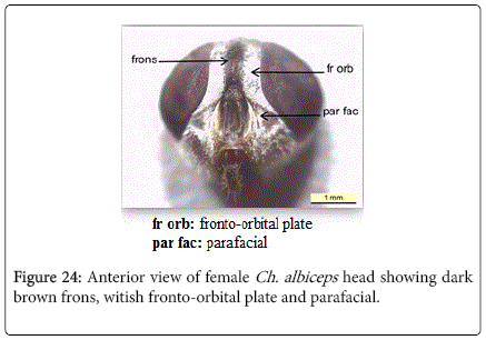 nursing-forensic-studies-fronto-orbital-plate-parafacial