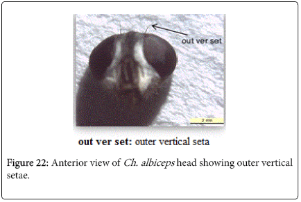 nursing-forensic-studies-head-showing-outer-vertical