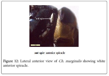 nursing-forensic-studies-showing-white-anterior-spiracle