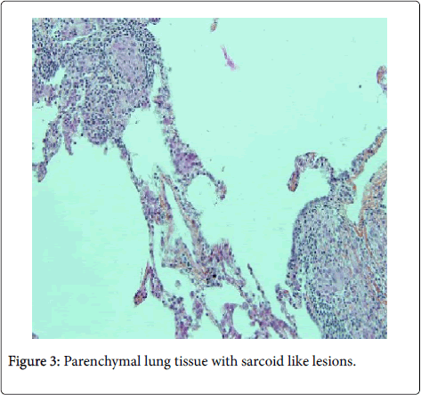 occupational-medicine-health-affairs-Parenchymal-lung-tissue
