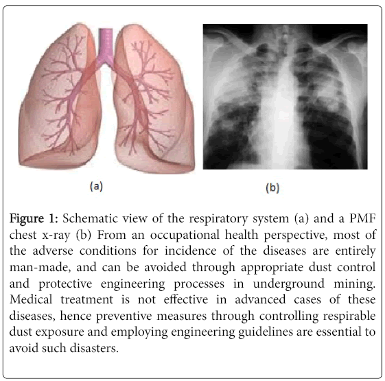 occupational-medicine-health-affairs-chest-x-ray