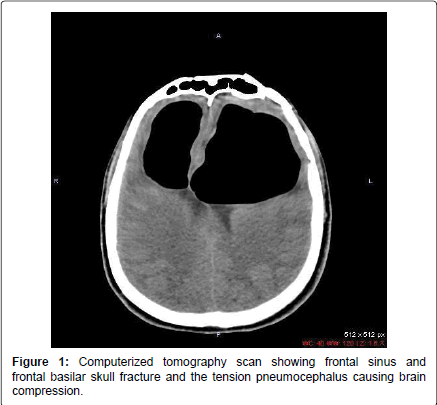 occupational-medicine-health-affairs-frontal-sinus