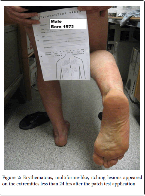 occupational-medicine-health-affairs-itching-lesions