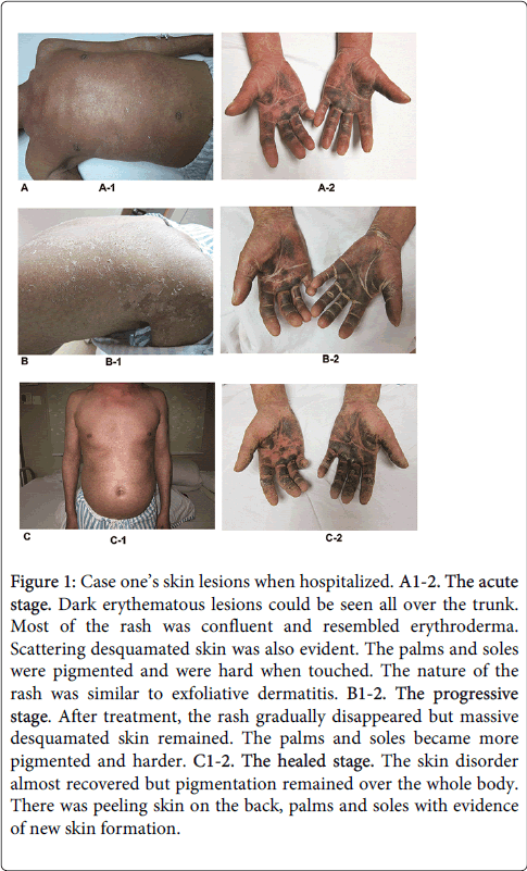 occupational-medicine-health-affairs-new-skin