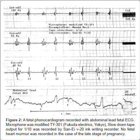 occupational-medicine-health-affairs-phonocardiogram-recorded