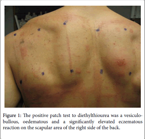 occupational-medicine-health-affairs-positive-patch