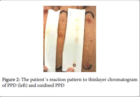 occupational-medicine-health-affairs-reaction-pattern