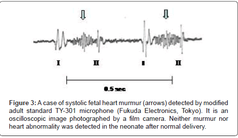 occupational-medicine-health-affairs-systolic-fetal