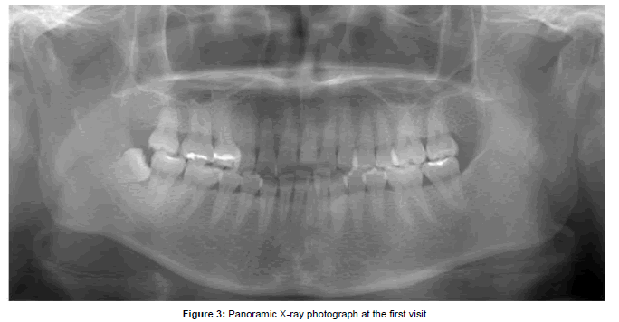 oral-hygiene-and-health-X-ray-photograph
