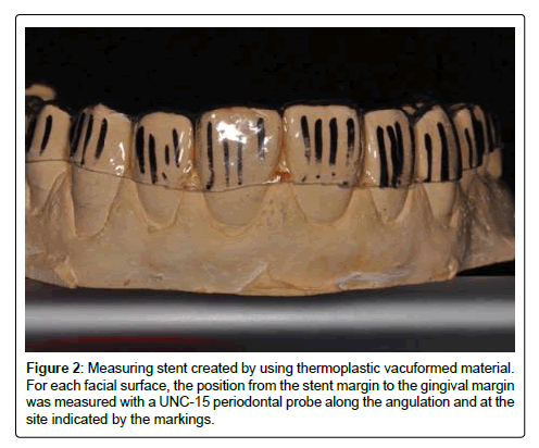 oral-hygiene-and-health-created