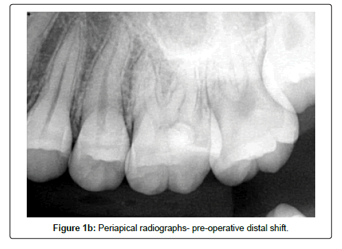 oral-hygiene-and-health-distal