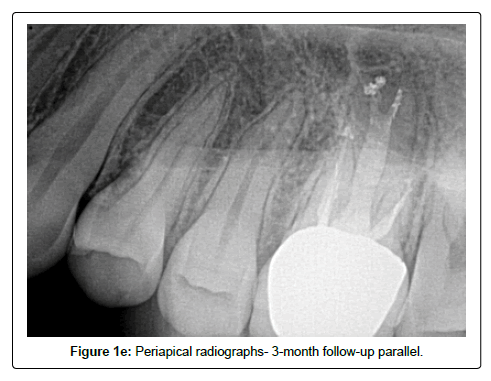 oral-hygiene-and-health-follow
