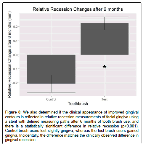 oral-hygiene-and-health-gingival
