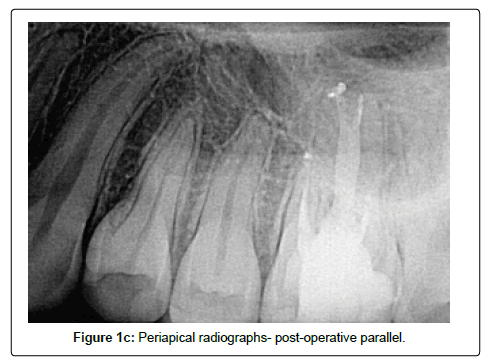 oral-hygiene-and-health-parallel