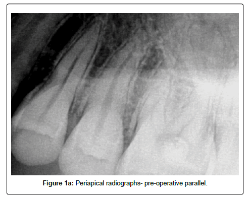oral-hygiene-and-health-radiographs
