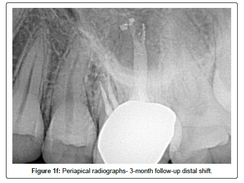 oral-hygiene-and-health-radiographs