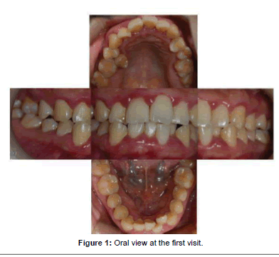 oral-hygiene-and-health-the-first-visit