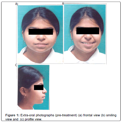oral-hygiene-health-Extra-oral-photographs