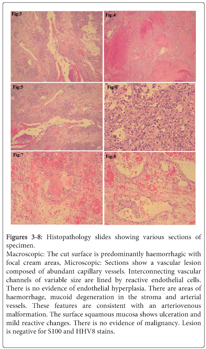 oral-hygiene-health-Histopathology