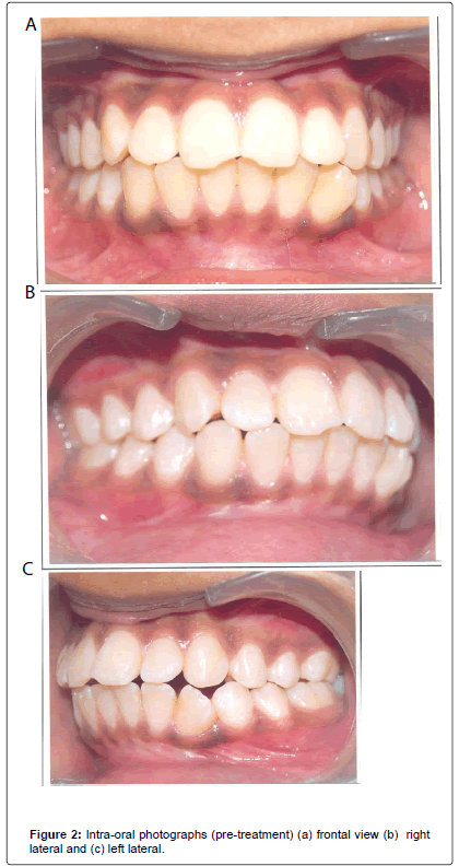 oral-hygiene-health-Intra-oral-photographs