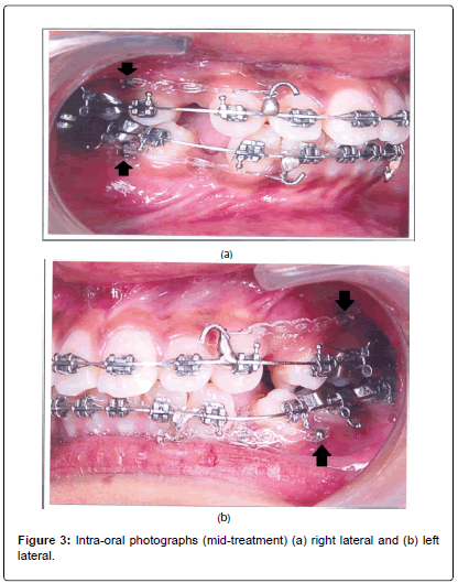 oral-hygiene-health-Intra-oral-photographs