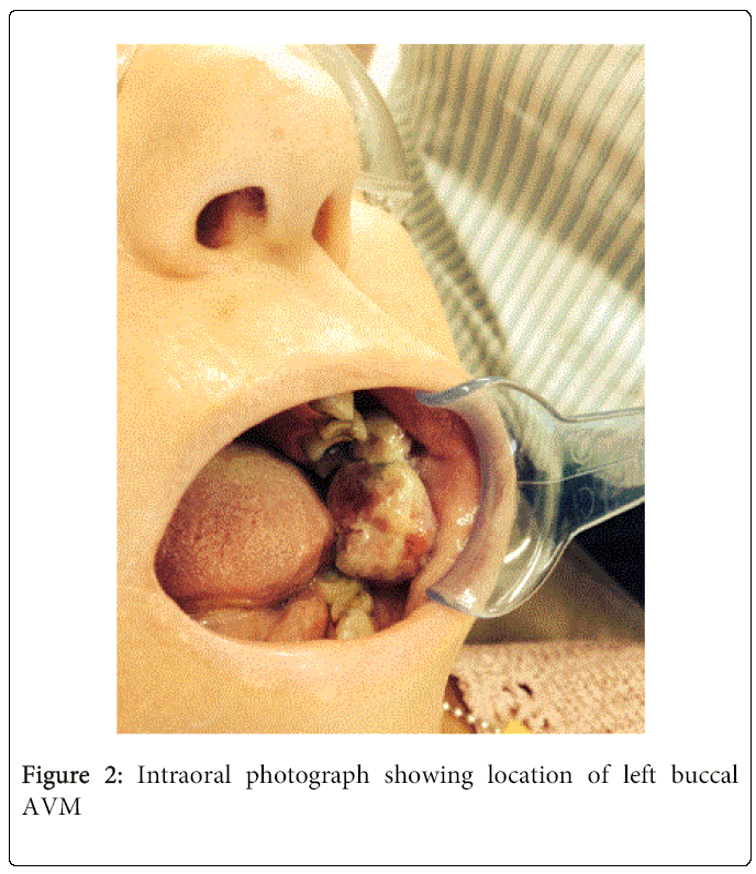 oral-hygiene-health-Intraoral