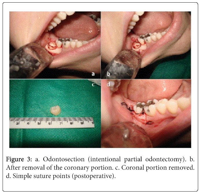 oral-hygiene-health-Odontosection