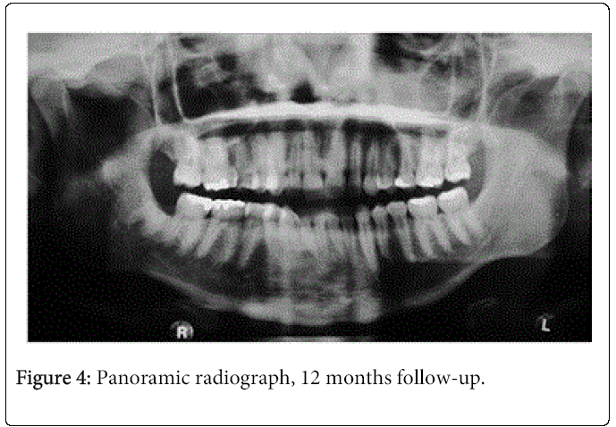 oral-hygiene-health-Panoramic